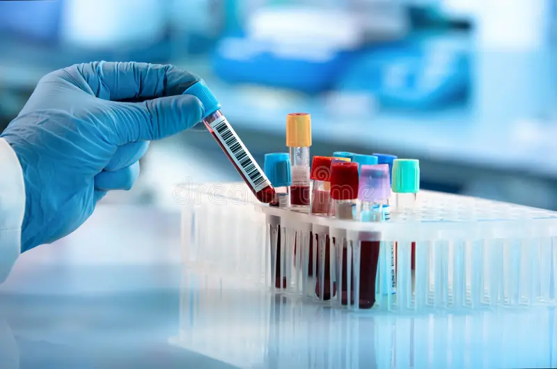Laboratory research technician reviewing analytical purity reports for alluvi tirzepatide research vials